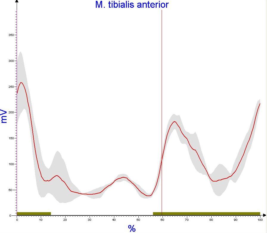 Abbildung Ensemblemittelung der Muskelaktivität am Beispiel Tibialis Anterior